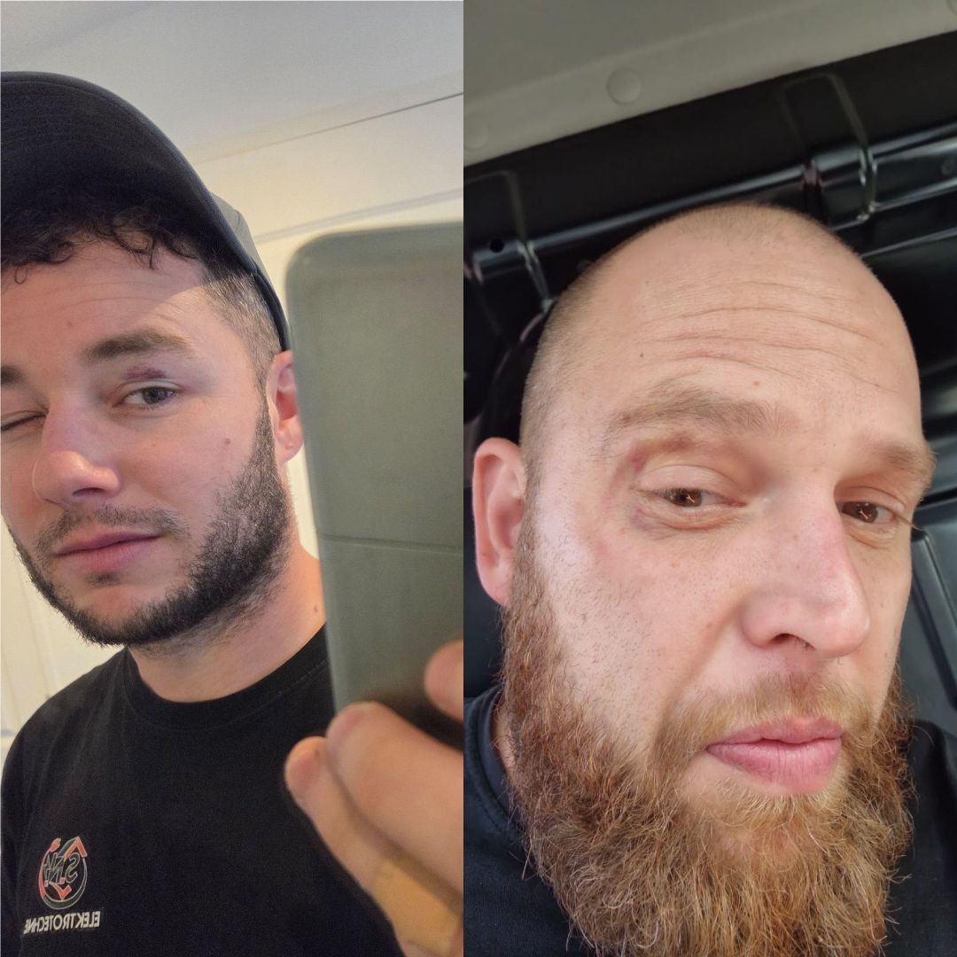 AFC Alex VS MrKrabs sparring 